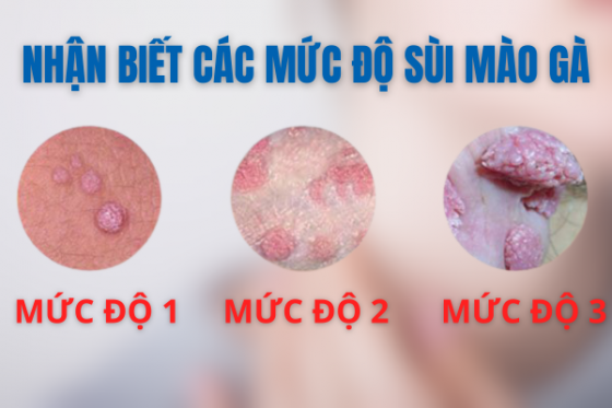bxh (18).png