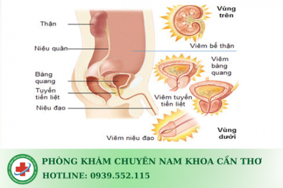 viem-nieu-dao-nam-la-gi.png