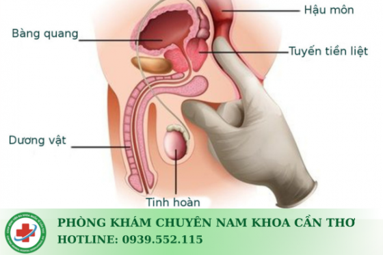 viem-tuyen-tien-liet-cap-tinh.png