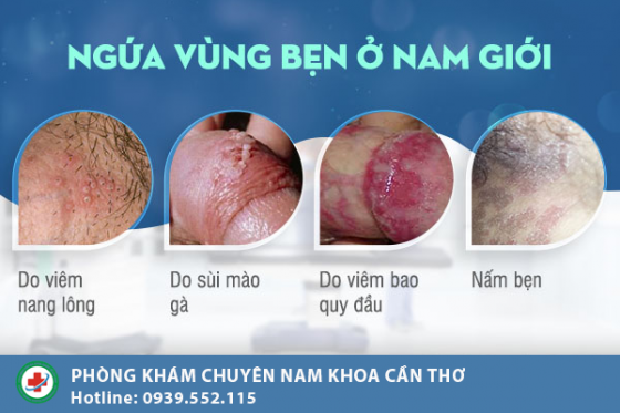 ngua-bo-phan-sinh-duc-nam-1.png