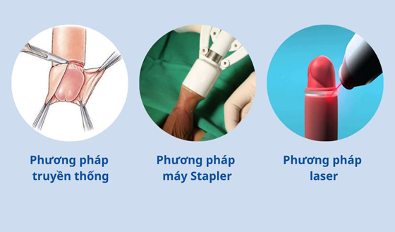 co-nen-cat-bao-quy-dau-khong-2.png